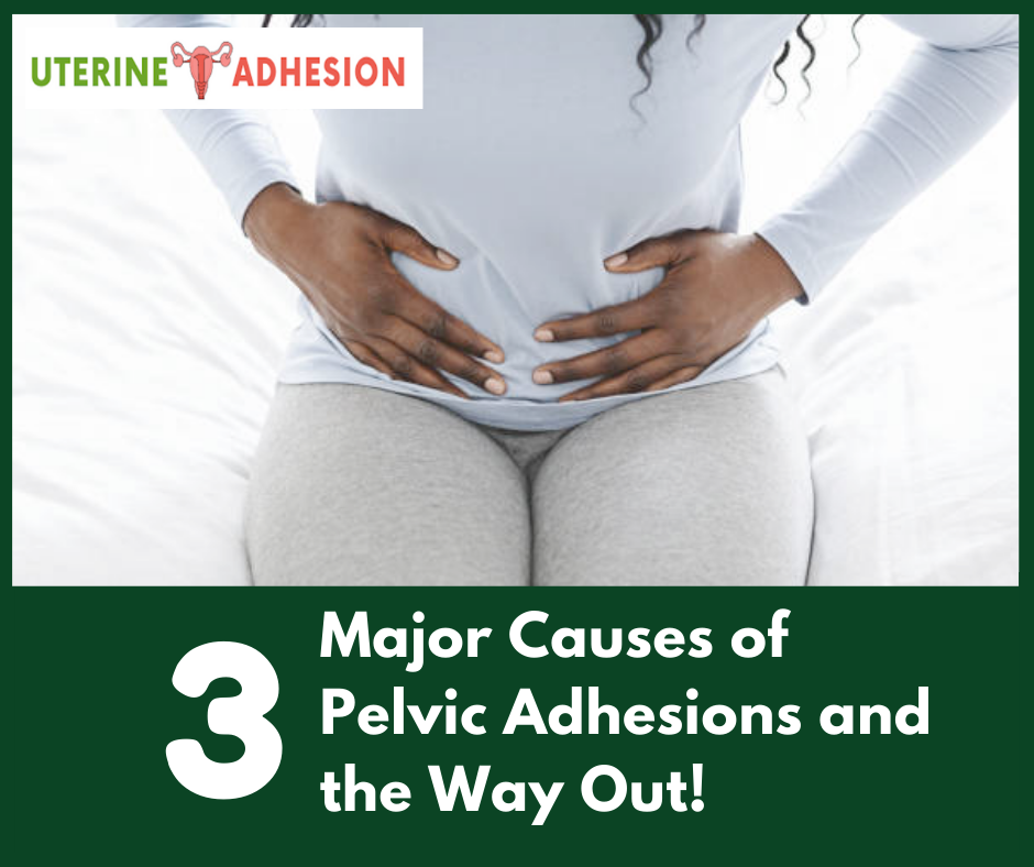 Pelvic Adhesions: The 3 Major Causes and the Way Out