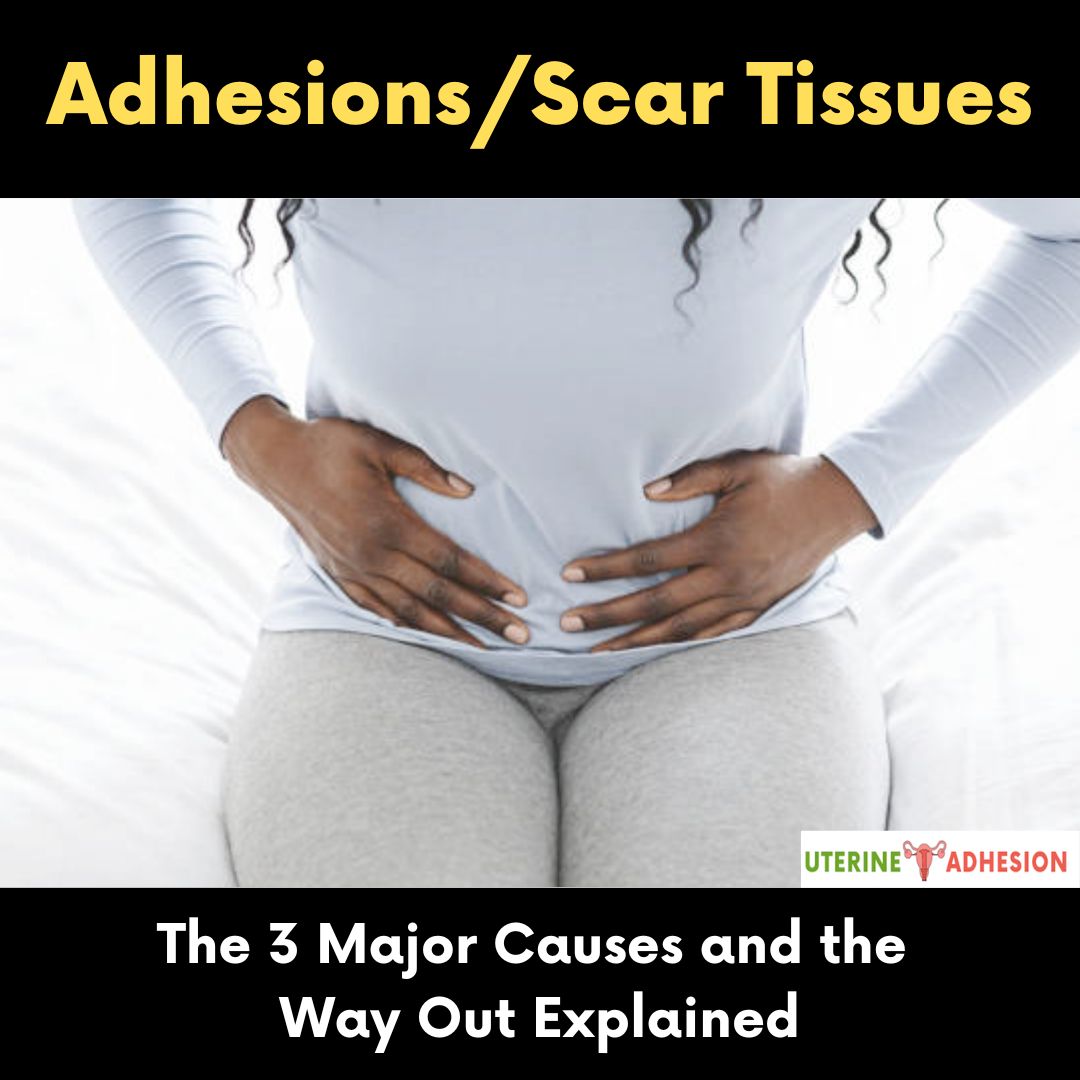 Adhesions/Scar Tissues: The 3 Major Causes and the Way Out Explained
