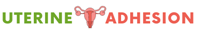 Uterine Adhesion-Uterine Adhesion Solution and Remedy Without Surgery