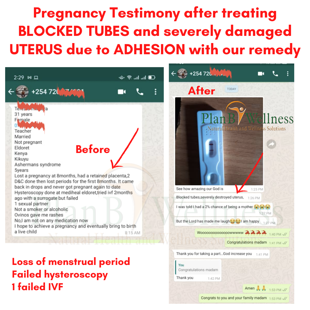 Pregnancy Testimony after treating BLOCKED TUBES and severely damaged UTERUS due to ADHESION with our remedy
