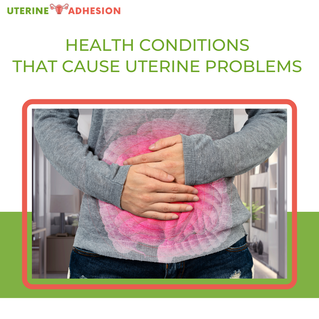 Health Conditions That Cause Uterine Problems