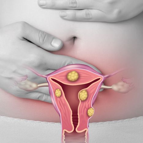 symptoms of uterine problems