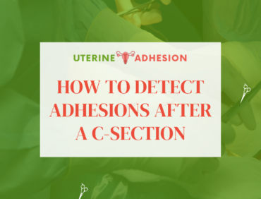 How to Detect Adhesions After a C-section