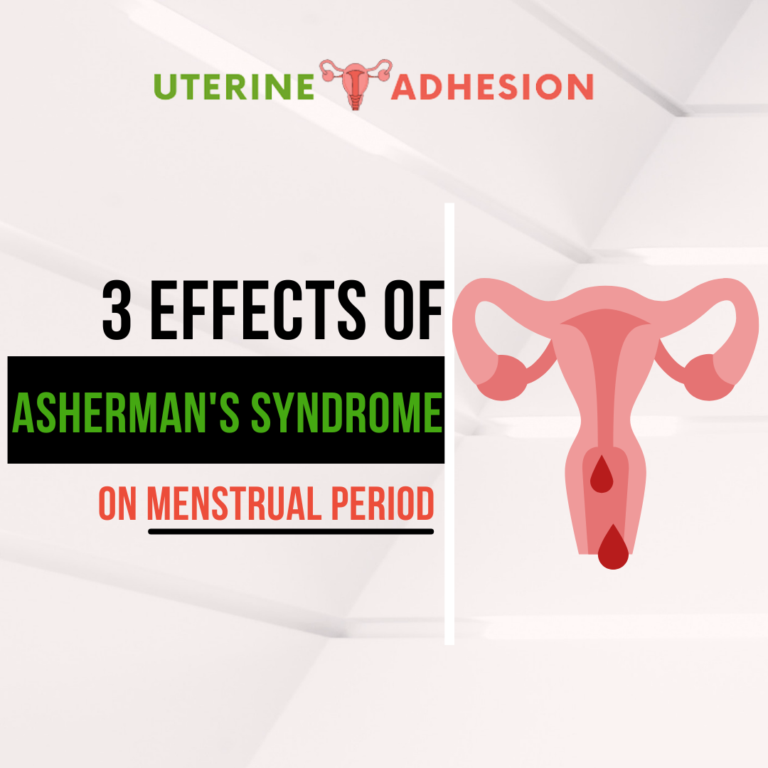 3 Effects of Asherman’s Syndrome on Menstrual Period